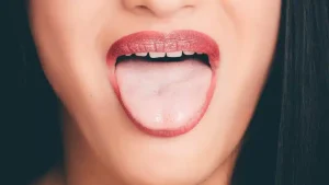 mouth cancer risk factors