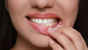 Periodontal Disease: Causes and Symptoms