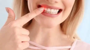 symptoms of gum recession