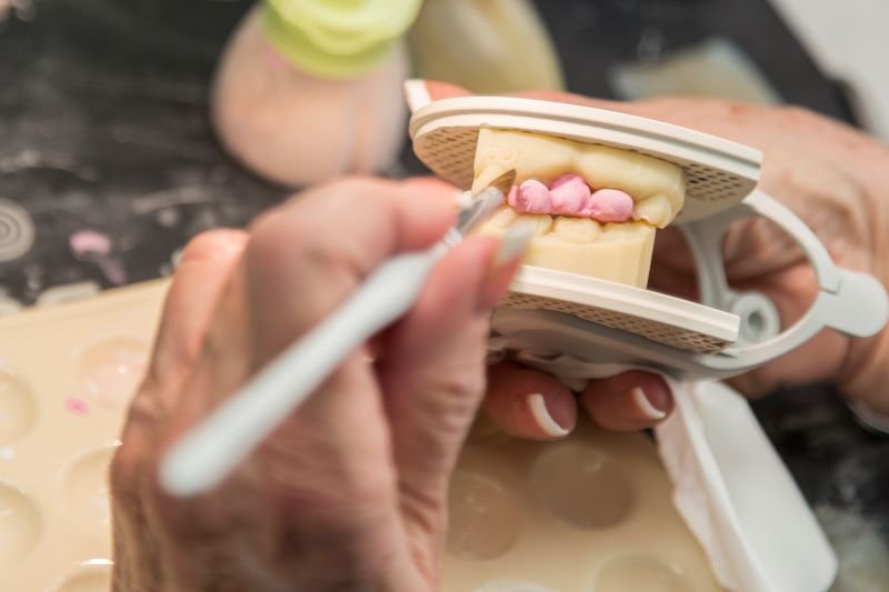 Bone grafting antalya