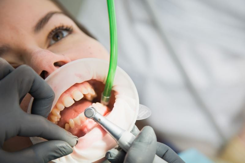 gum treatment turkey