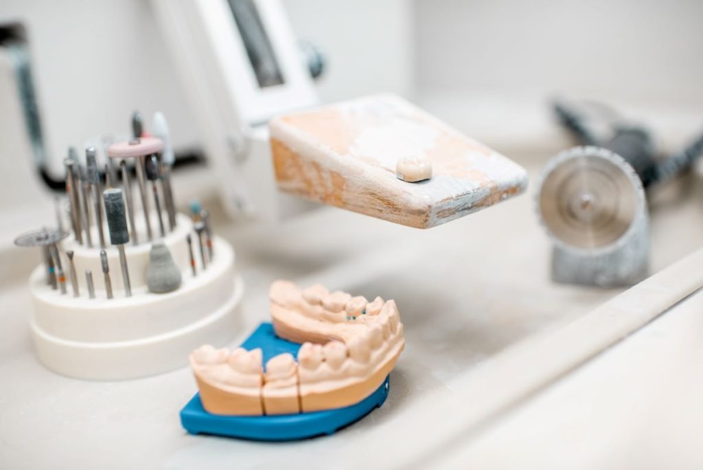 Dental Bridge Treatments in Antalya