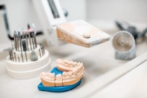 Top Benefits of Dental Bridge Treatments in Antalya, Turkey