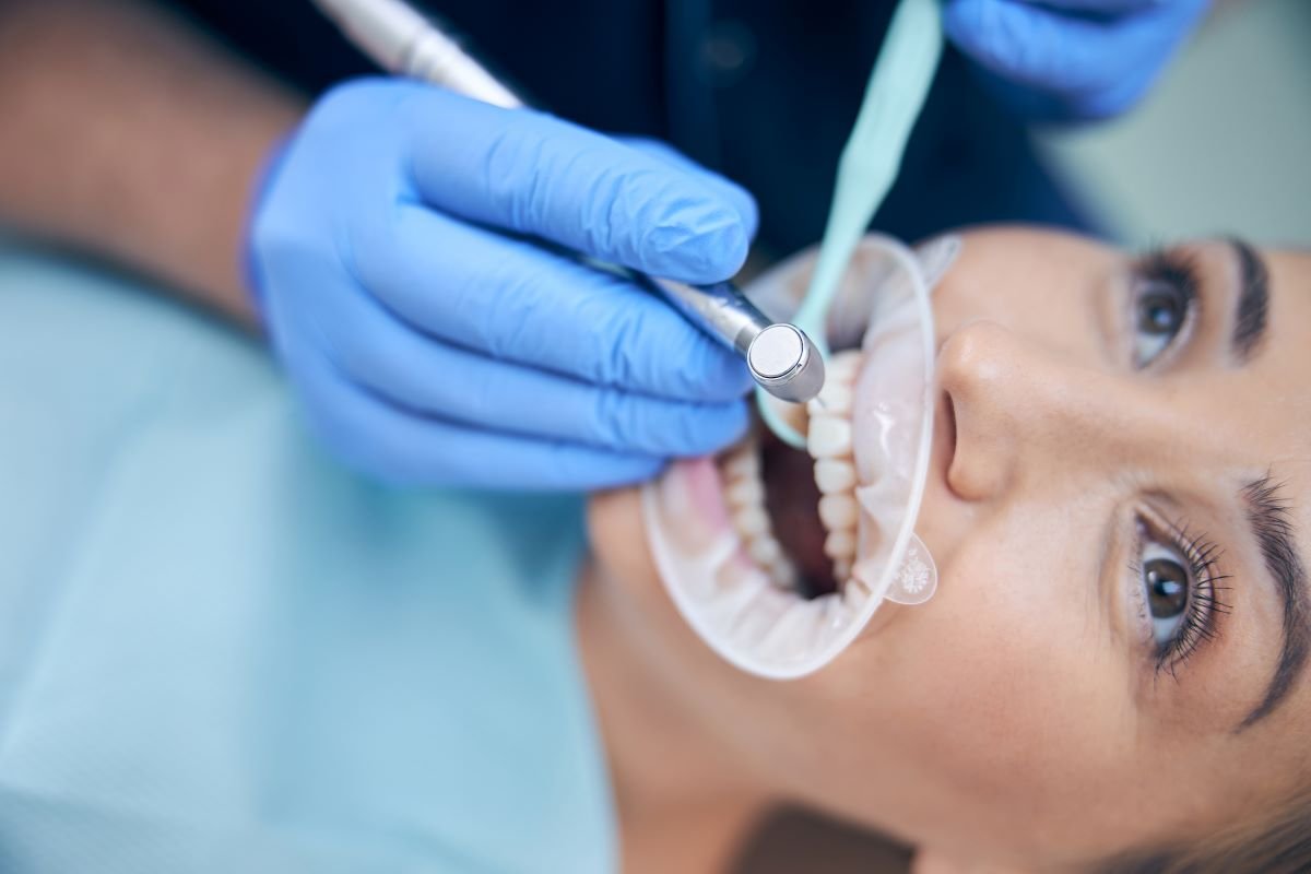 Teeth Whitening in Antalya