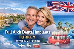 Full Arch Dental Implants in Turkey: A Trusted Solution for a Complete Smile